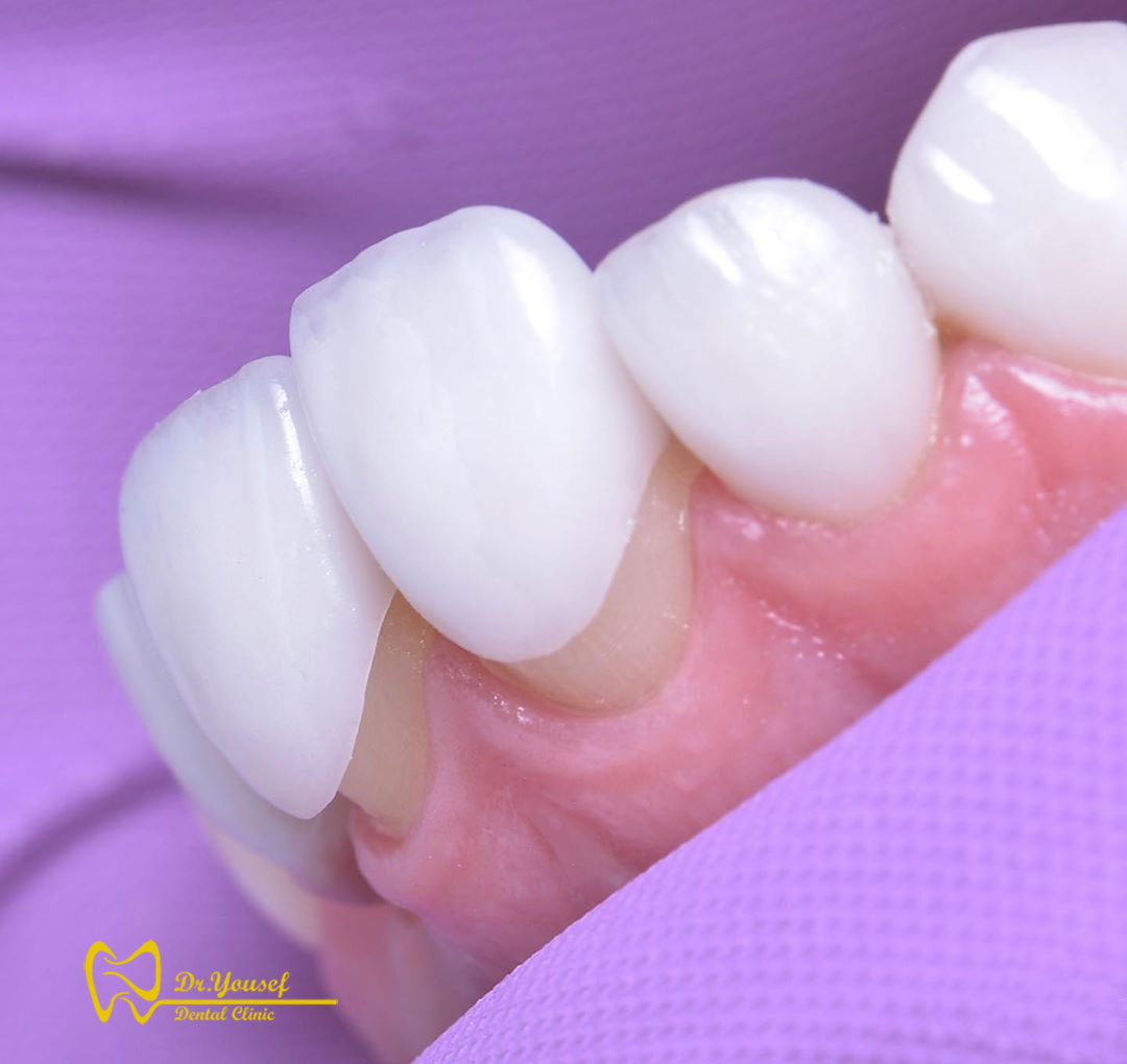 دندانپزشکی زیبایی در سعادت آباد