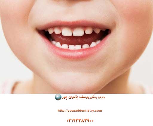 دندانپزشکی کودکان