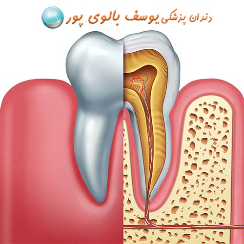عصب کشی دندان
