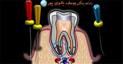 دندانپزشکی دکتر یوسف بالوی پور