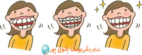 ارتودنسی دندان