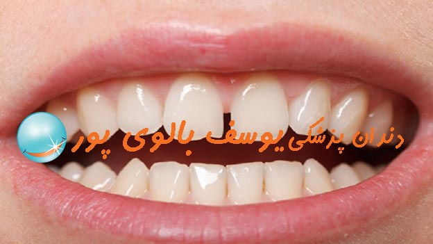 دندانپزشکی بالوی پور