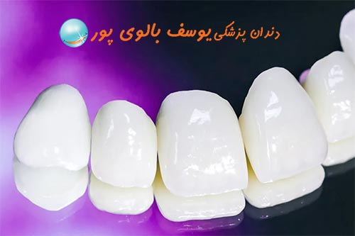 عصب کشی دندان