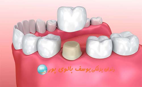 دندانپزشکی دکتر یوسف بالوی پور
