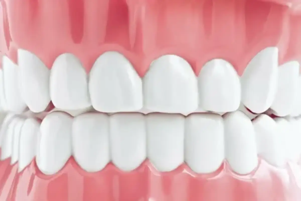 gums 1