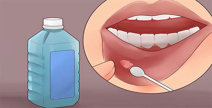 تمیز کردن دهان با دهانشویه