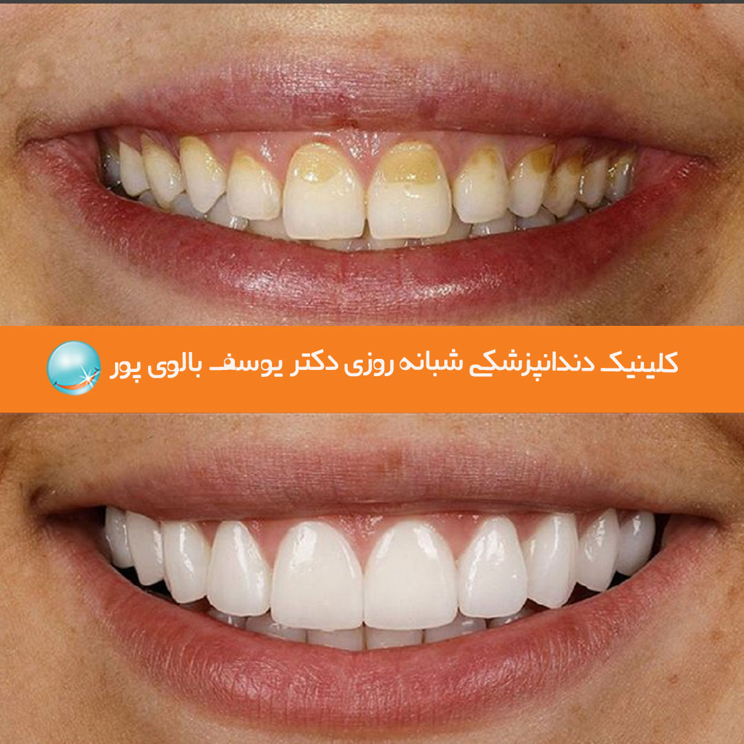 تاثیرات بارداری بر سلامت دهان و دندان 